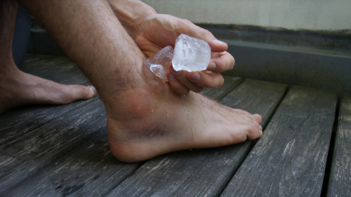 Foto ICE