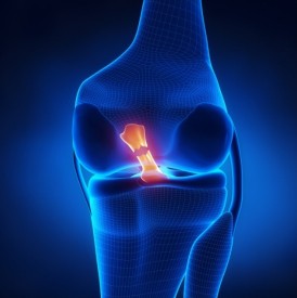 ACL rupture.jpg